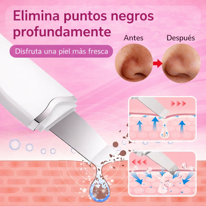 Espátula Ultrasónica Facial™ | Limpieza profunda